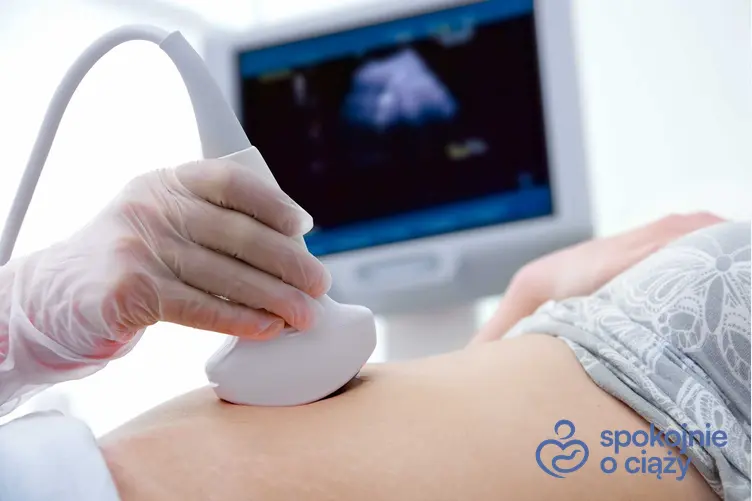 USG w ciąży, a także drugi miesiąc ciąży oraz zalecenia lekarskie i badania w ciąży