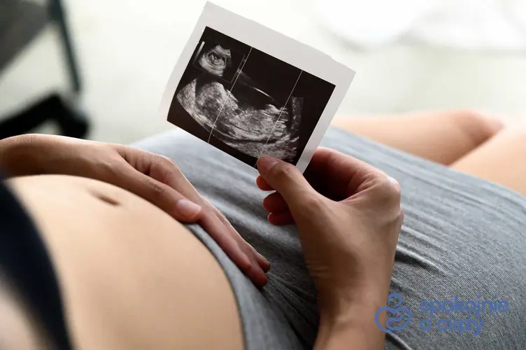 Kobieta w ciąży z USG, a także jaka jest waga dziecka w ciąży krok po kroku