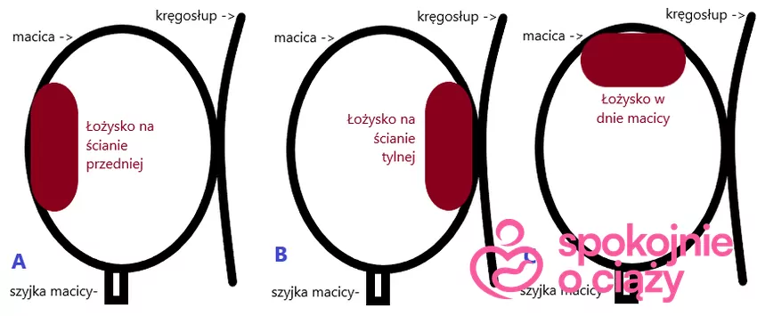 Lokalizacje łożyska w ciąży