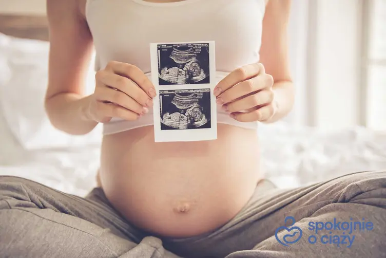 Kobieta z USG ciąży, a także ciąża donoszona od którego tygodnia ciąży