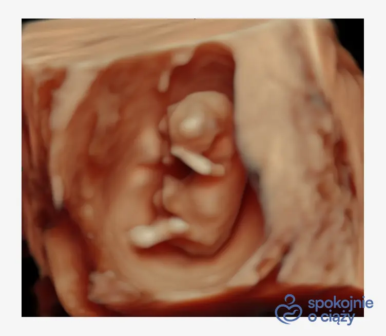 Dziecko w 15. tygodniu ciąży. Obraz słabszej jakości ze względu na tkankę tłuszczową