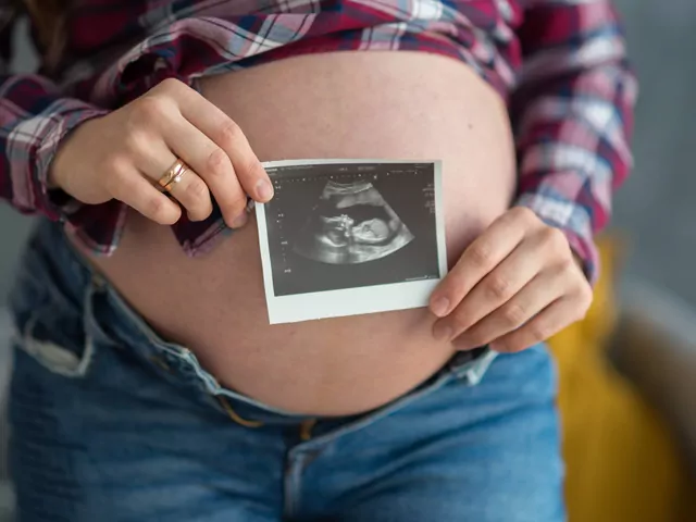 Pępowina dwunaczyniowa i trójnaczyniowa