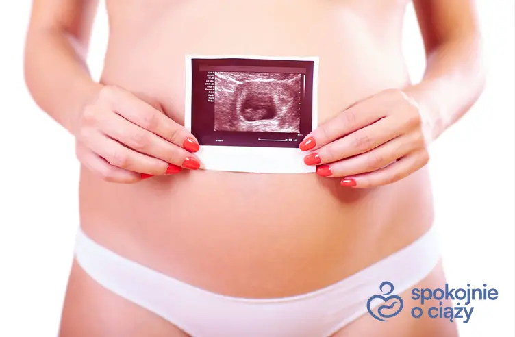 Kobieta w ciąży trzymająca zdjęcie USG na wysokości brzucha, a także informacje, jak wygląda 9 tydzień ciąży bez tajemnic
