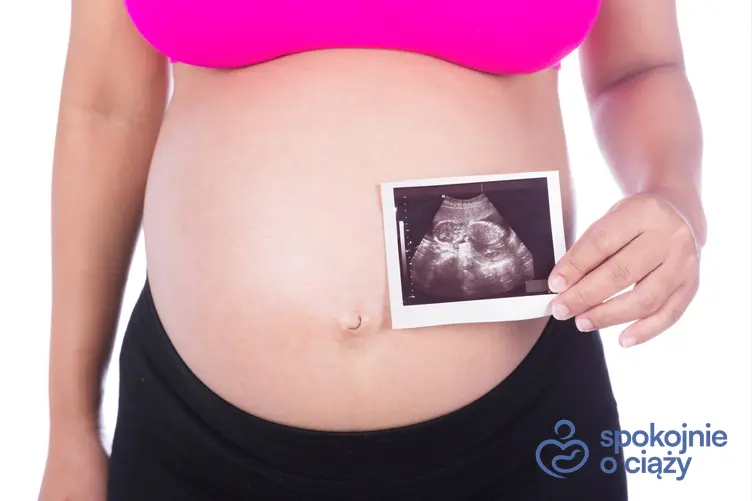 Kobieta w zaawansowanej ciąży trzymająca zdjęcie USG, a także kiedy można poznać płeć dziecka w USG