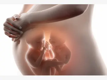 Ilustracja artykułu ciąża bliźniacza - położna wyjaśnia, co trzeba wiedzieć