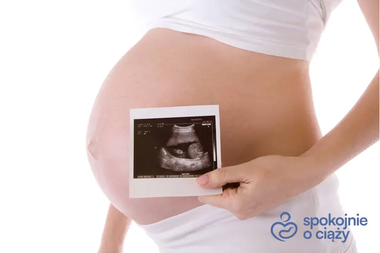 Kobieta w zaawansowanej ciąży ze zdjęciem USG, a także uczucie rozpierania w pochwie w ciąży bez tajemnic