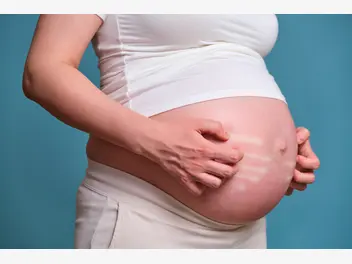 Ilustracja artykułu swędzenie skóry w ciąży – położna radzi, co można zrobić