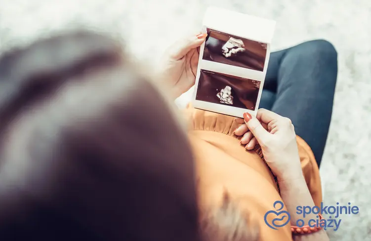 Kobieta w ciąży oglądająca zdjęcie USG, a także tabela z poradami, który to tydzień ciąży