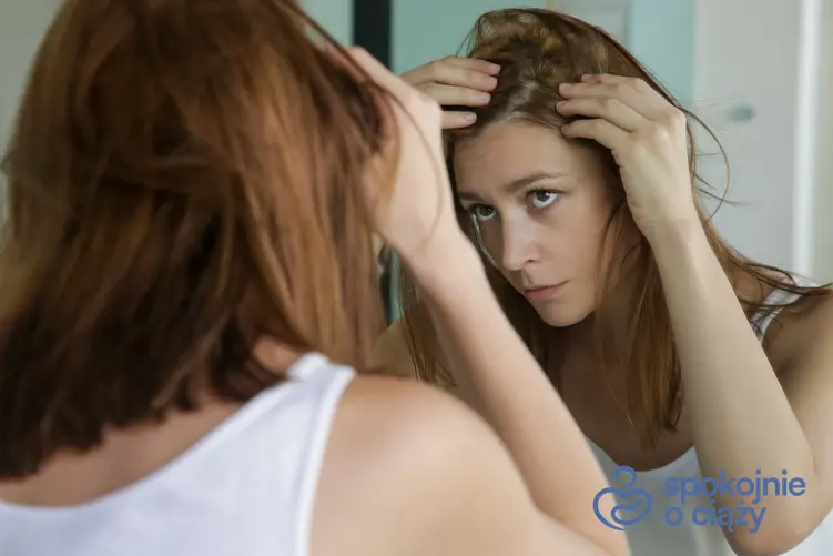 Kobieta sprawdzająca zakola w lustrze, a także wypadanie włosów po ciąży bez tajemnic
