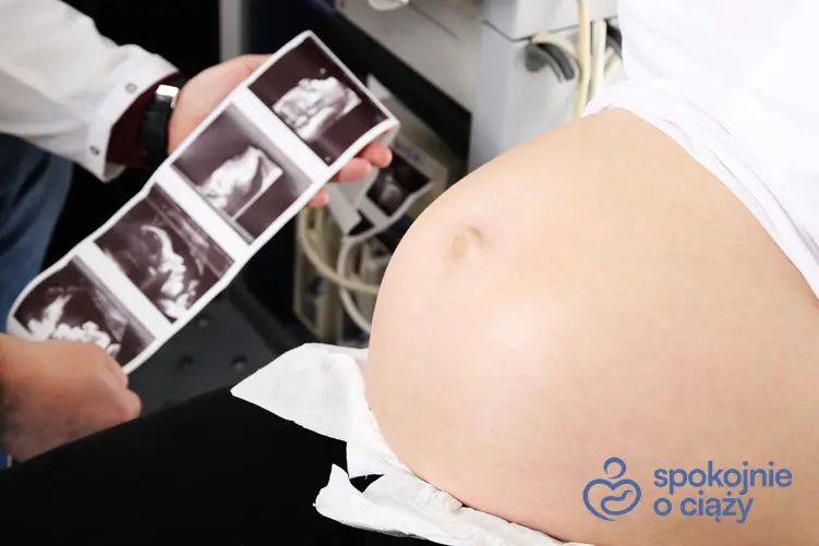 Kobieta w zaawansowanej ciąży podczas USG, a także nadżerka szyjki macicy w ciąży