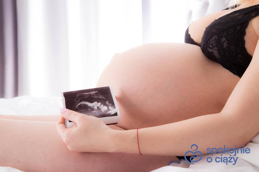 Kobieta w zaawansowanej ciąży trzymająca zdjęcie USG na wysokości brzucha, a także test Manninga krok po kroku