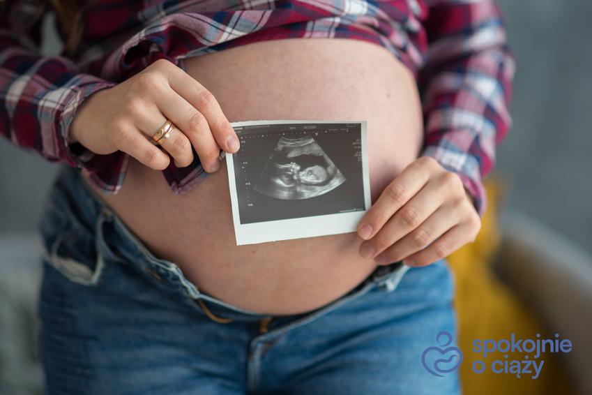 Kobieta w ciąży trzymająca zdjęcie USG na wysokości brzucha, a także pępowina dwunaczyniowa i trójnaczyniowa