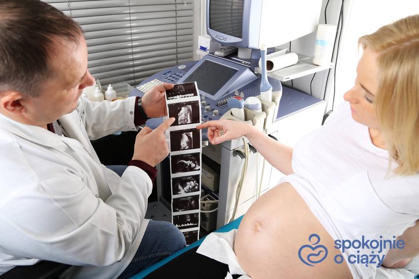 Kobieta w ciąży podczas badania USG u lekarza ginekologa, a także porady, czy USG jest szkodliwe dla dziecka