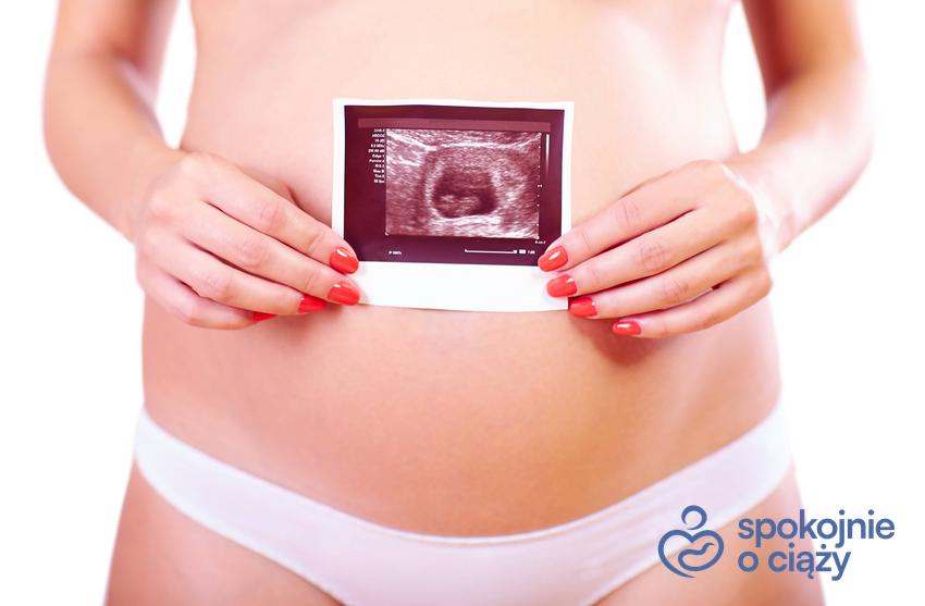 Kobieta w ciąży trzymająca zdjęcie USG na wysokości brzucha, a także informacje, jak wygląda 9 tydzień ciąży bez tajemnic