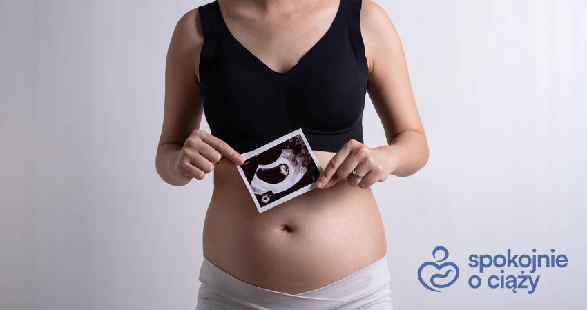 Kobieta w ciąży ze zdjęciem USG na wysokości brzucha, a także 10 tydzień ciąży krok po kroku