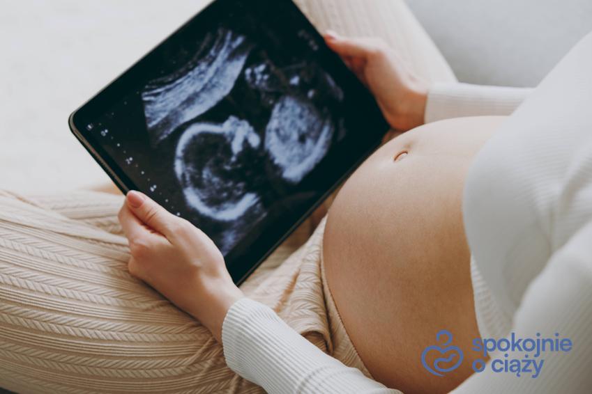 Kobieta w zaawansowanej ciąży trzymająca USG na tablecie, a także porady, jak obliczyć termin porodu