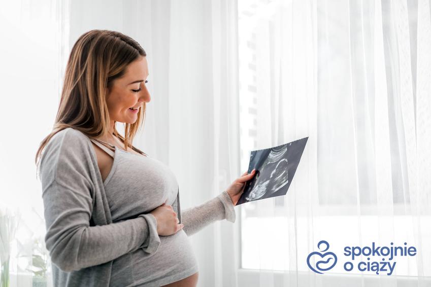 Kobieta w zaawansowanej ciąży trzymająca wydruk badania USG, a także porady, od czego zależy płeć dziecka