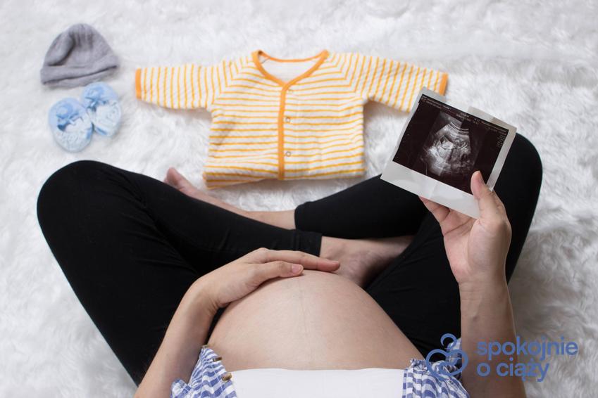 Kobieta w zaawansowanej ciąży trzymająca zdjęcie USG i ubranka, a także informacje, od czego zależy płeć dziecka