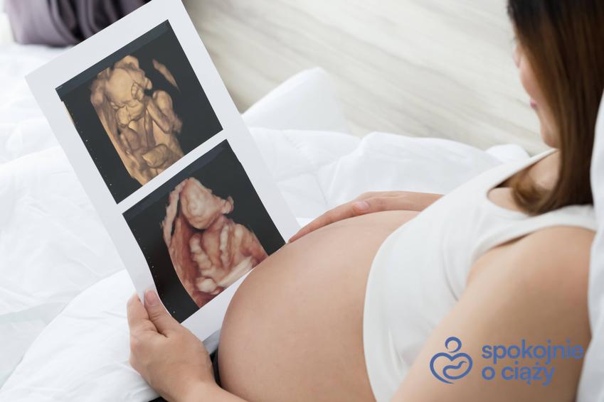 Kobieta w zaawansowanej ciąży siedząca ze zdjęciem USG, a także położenie płodu w USG krok po kroku