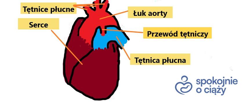 Poglądowy rysunek serca ukazujący umiejscowienie przewodu tętniczego u płodu
