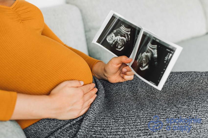 Zdjęcie USG kobiety w drugim trymestrze ciąży oraz dolegliwości i objawy w ciąży