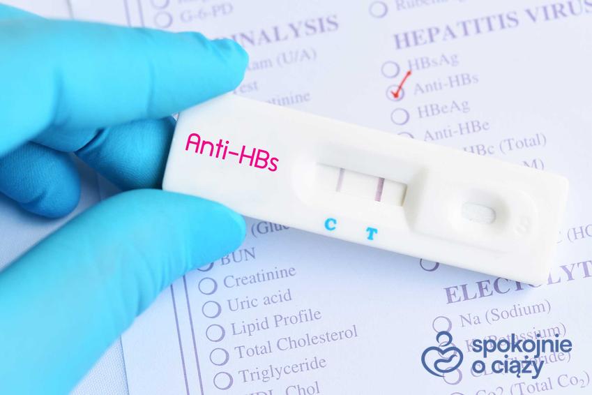 Test na antygen HBS a także badanie antygenu HBS w ciąży oraz kiedy je wykonać