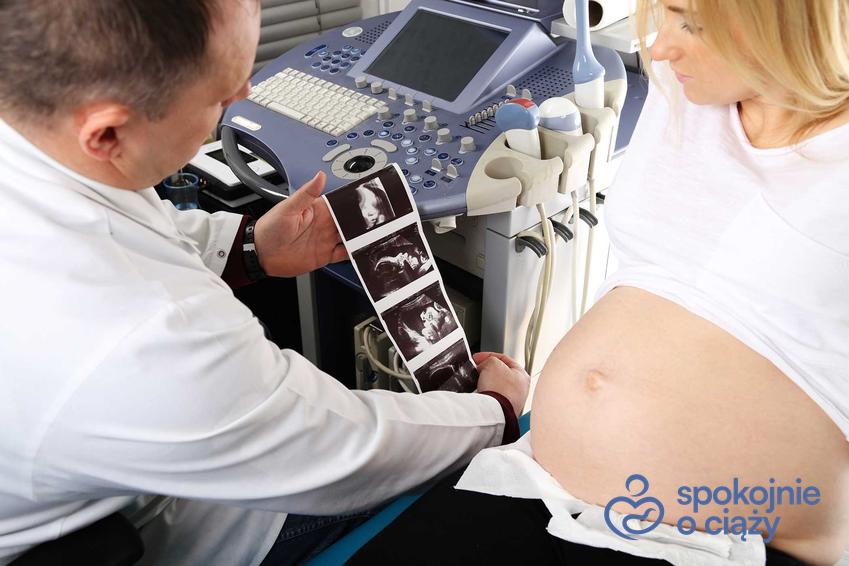 Lekarz pokazujacy kobiecie USG ciąży, a także tabela norm USG płodu