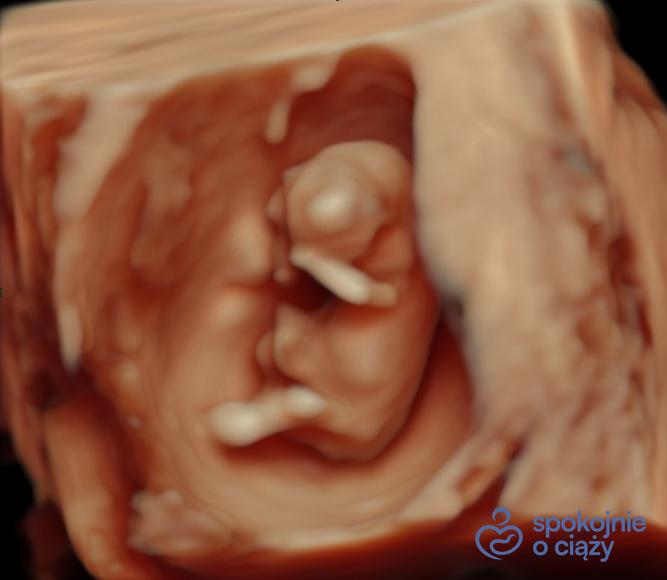 Dziecko w 15. tygodniu ciąży. Obraz słabszej jakości ze względu na tkankę tłuszczową