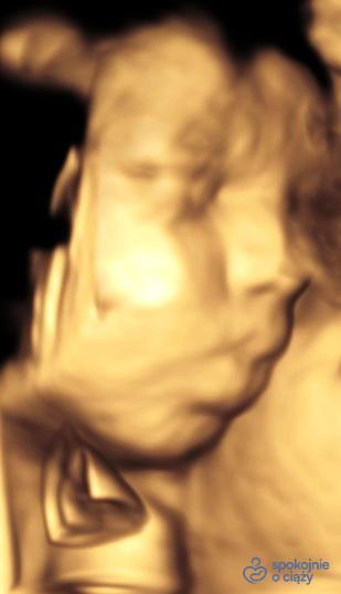 Twarz dziecka w 32. dniu ciąży. Słabsza jakość zdjęcia ze względu na jego pozycję w macicy