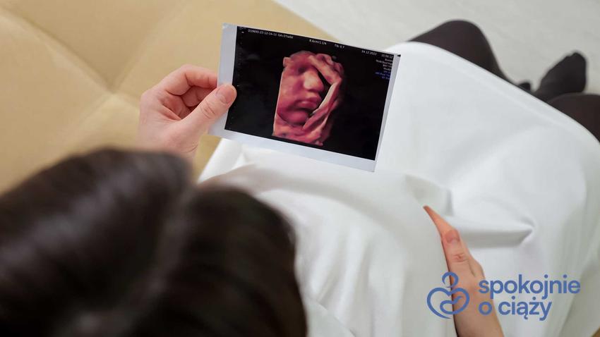 Kobieta ze zdjęciem USG w ciąży, a także makrosomia płodu, zagrożenia, objawy i przyczyny