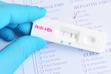 Antygen HBs w ciąży - co to za badanie i kiedy je wykonać?