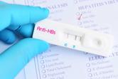 Antygen HBs w ciąży - co to za badanie i kiedy je wykonać?